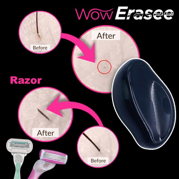 WOW Erasee Nano Crystal Painless Hair Removal Buffer | As Seen On TikTok! | Ships Late May Preorder Showcase 