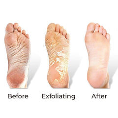 RevivaFoot Exfoliating Foot Peel Masks (2pk) | As Seen On Social! Simple Showcase 