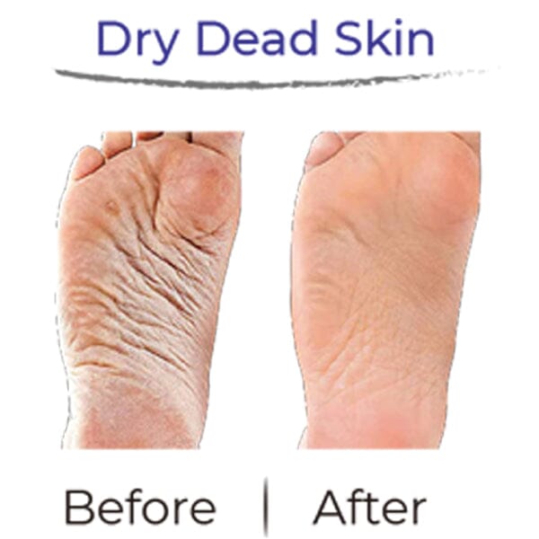 RevivaFoot Exfoliating Foot Peel Masks (2pk) | As Seen On Social! Simple Showcase 